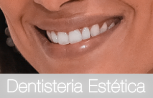 Dentisteria Estética copy