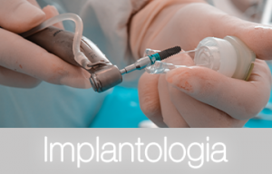 Implantologia copy